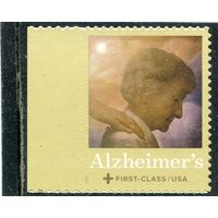 США. Болезнь Альцгеймера